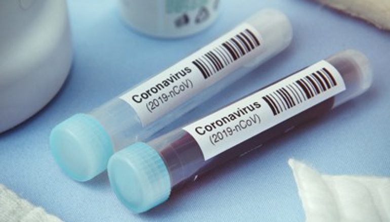 ‘Vaccines’ Containing Blood of Recovered #COVID19 Patients for Sale on Dark Web